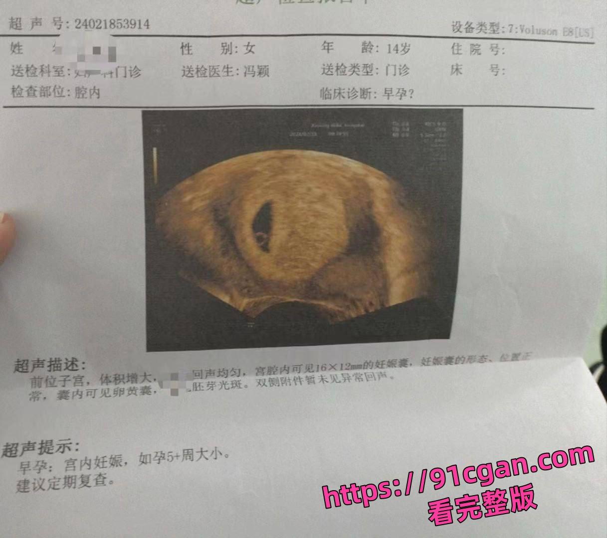 旷世渣男将涉世未深的14岁学生妹 冯颖 搞怀孕后还到处炫耀自己的成果极其下头！-7