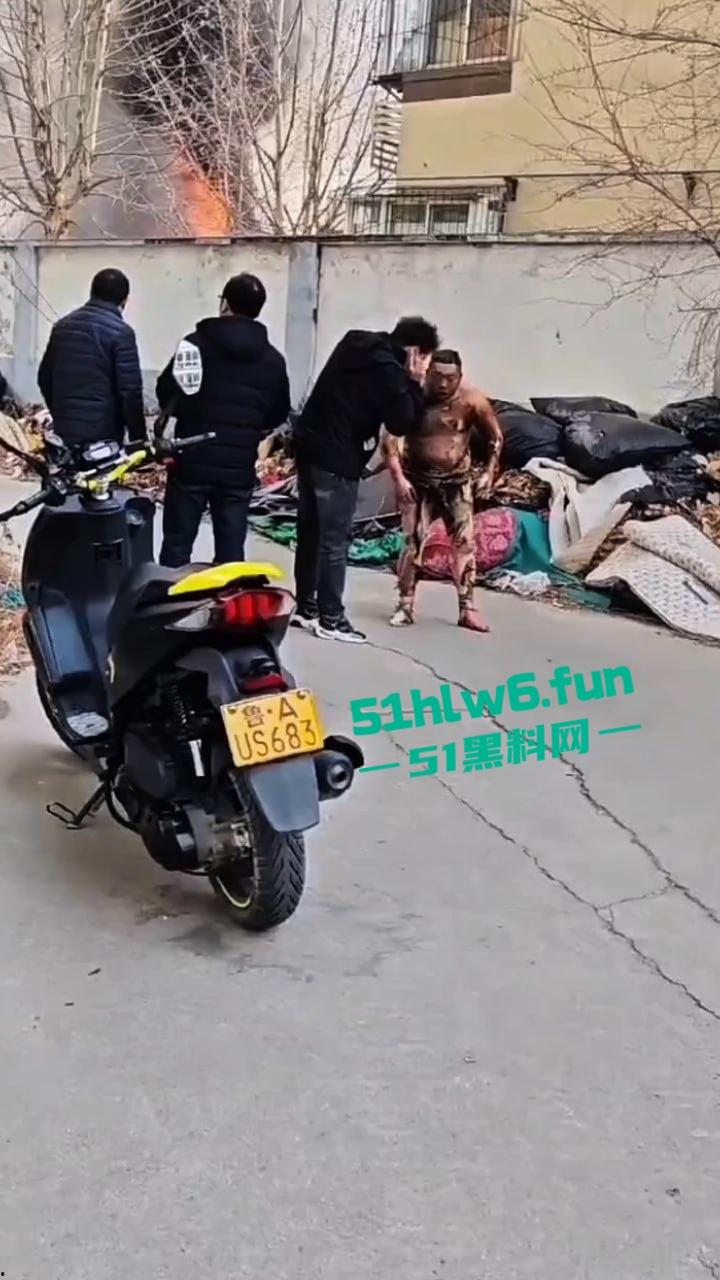 山东济南一小区发生火灾，男子被烧的体无完肤，经调查是邻居大妈积攒的废品导致烧成这样也太惨了。